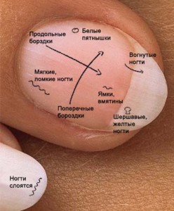 Интересные Ногти Фото